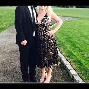 Dress the population nude and black dress